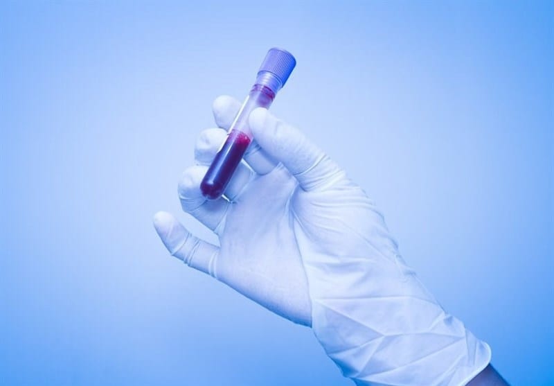 Detecting Alzheimer’s Gets Easier with a Simple Blood Test thumbnail image