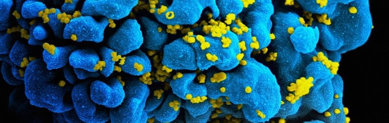 New Research Demonstrates Enhanced Sensitivity For Acute HIV Detection Using Quanterix’ Simoa Technology thumbnail image