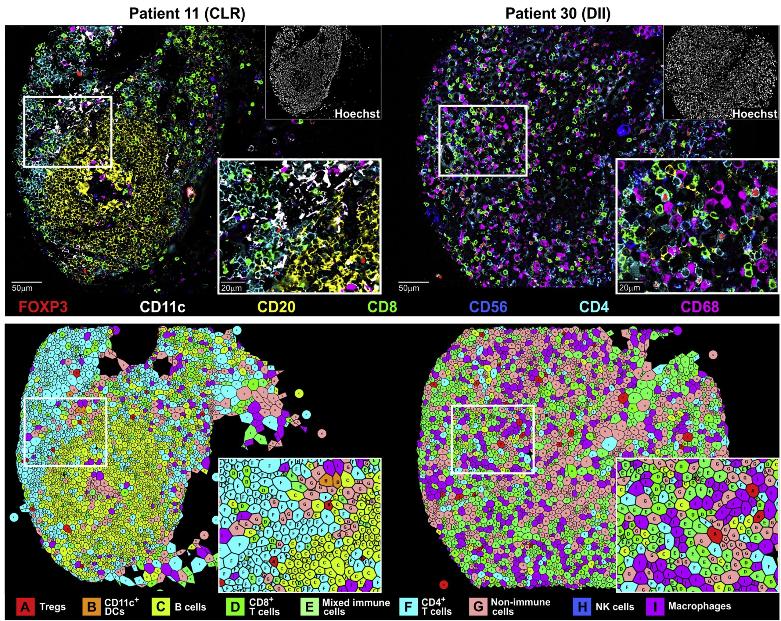 Spatial Analysis of Cellular Neighborhoods: Uncovering Complex ...
