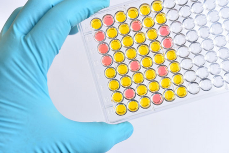 What You Need to Know About Multiplex Assays VS. ELISA When Assessing Complex Disease States thumbnail image