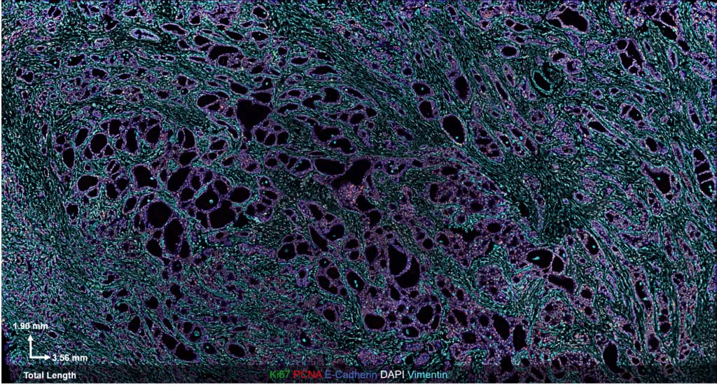 36-Plex CODEX Breast Cancer FFPE Panel Recapitulates Published